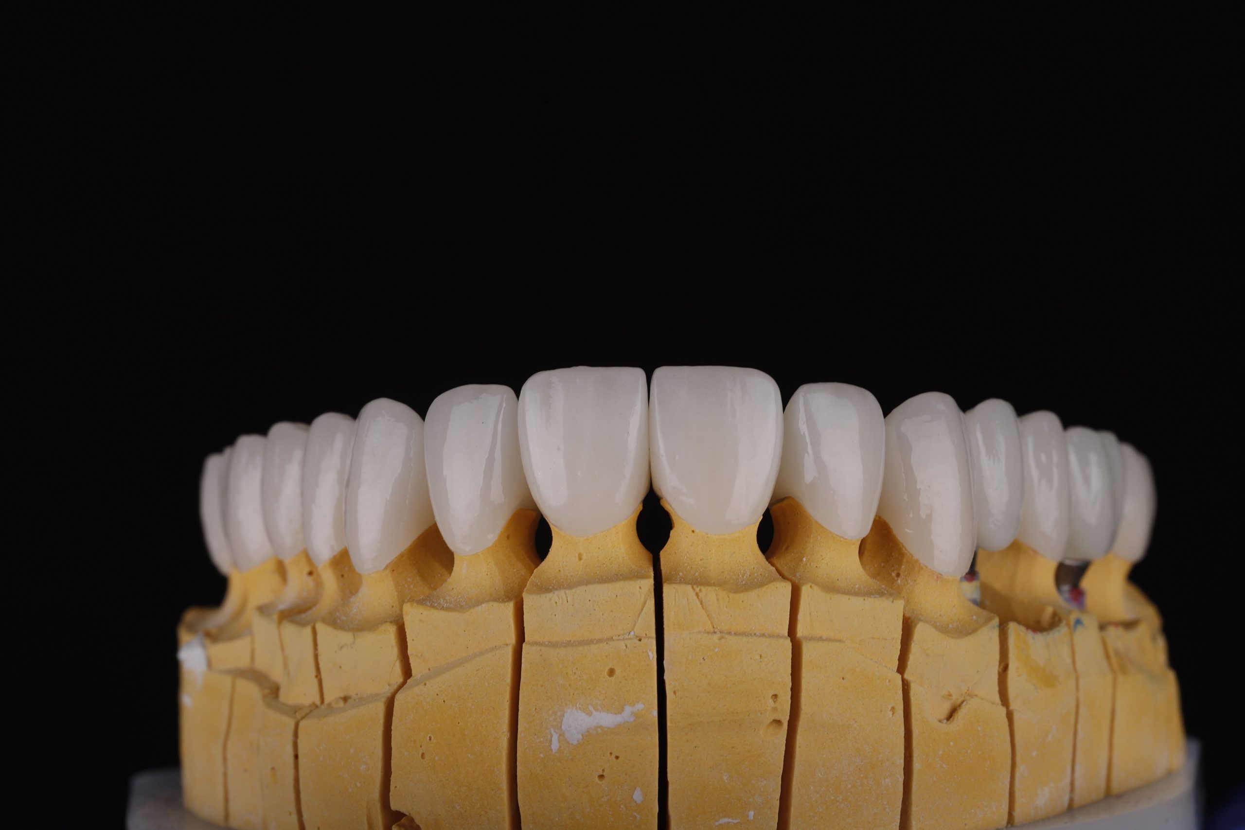 Präzise Zahntechnik